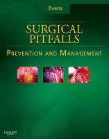 Surgical Pitfalls E-Book_nodrm.pdf